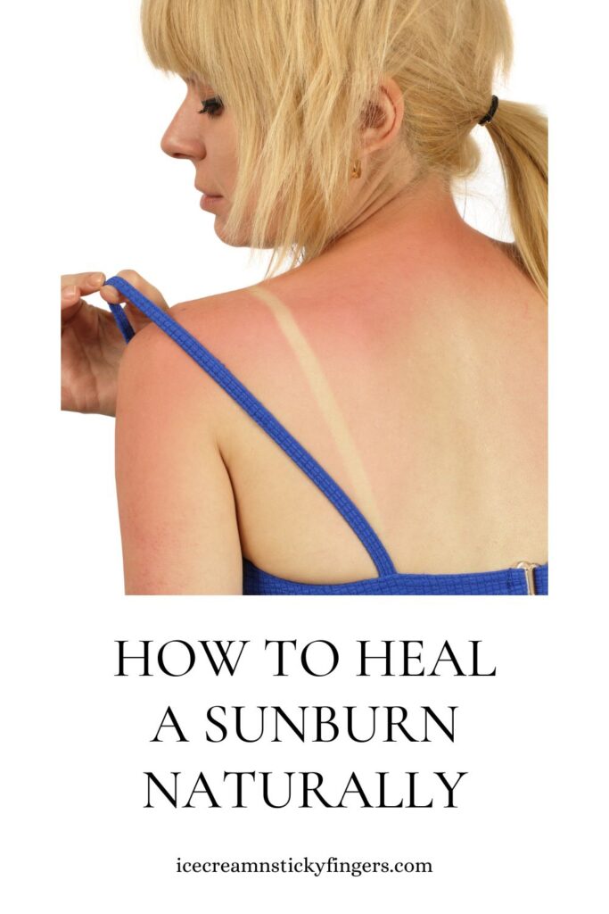 How to Heal a Sunburn Naturally