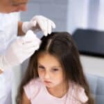 Kids and Head Lice What You Need to Know
